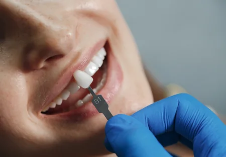 Dental Implants Surgery at Vasavi Hospitals
