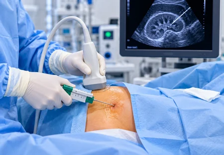 Kidney Biopsy at Vasavi Hospitals