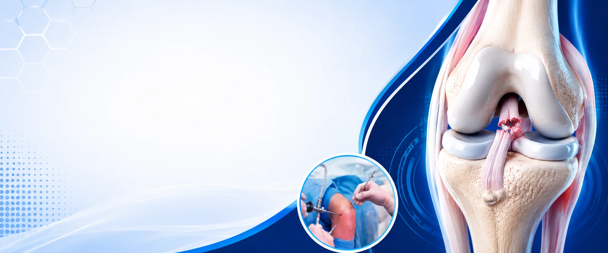ACL Reconstruction Surgery in Bangalore - Vasavi Hospitals