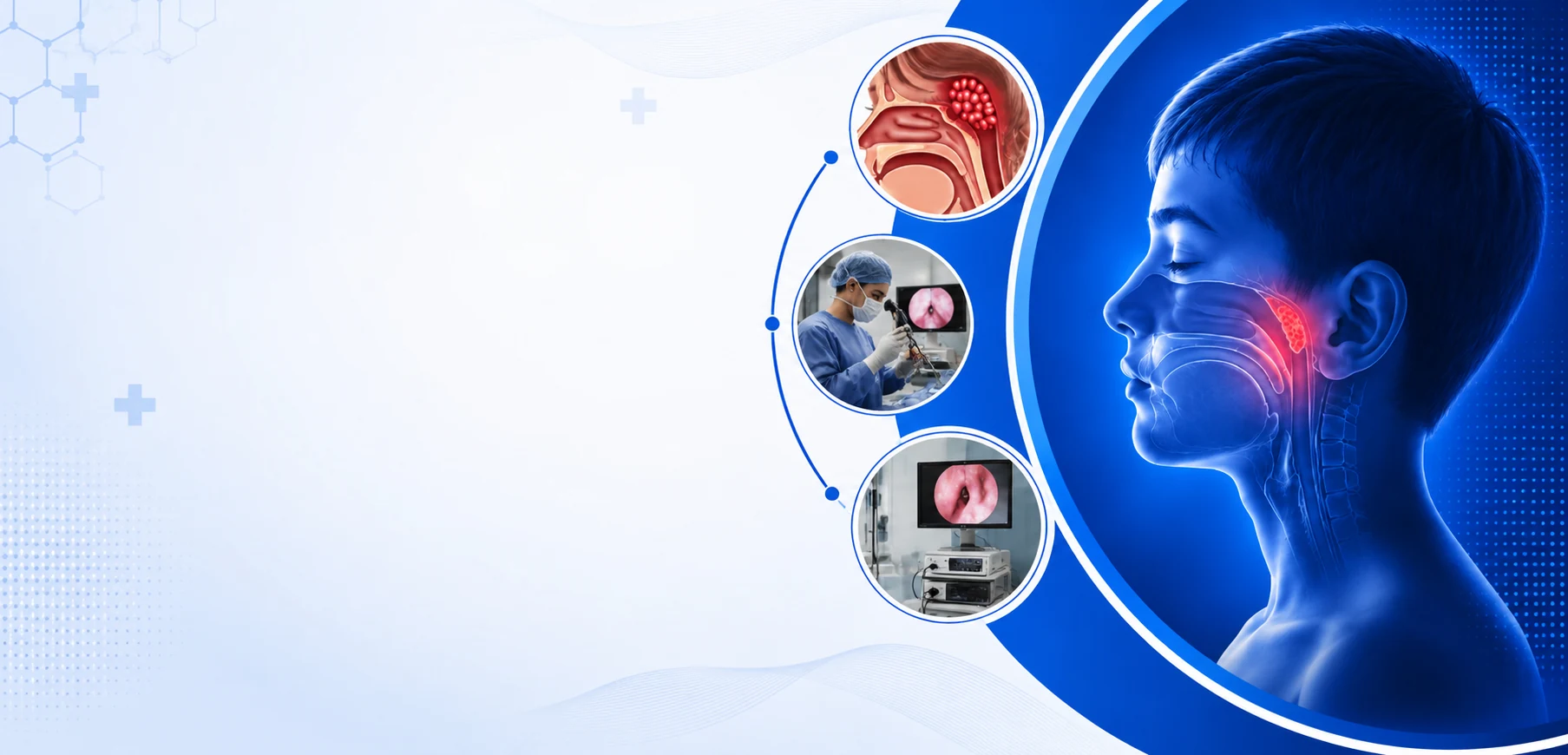 Advanced Adenoid Removal Surgery in Bangalore - Vasavi Hospitals