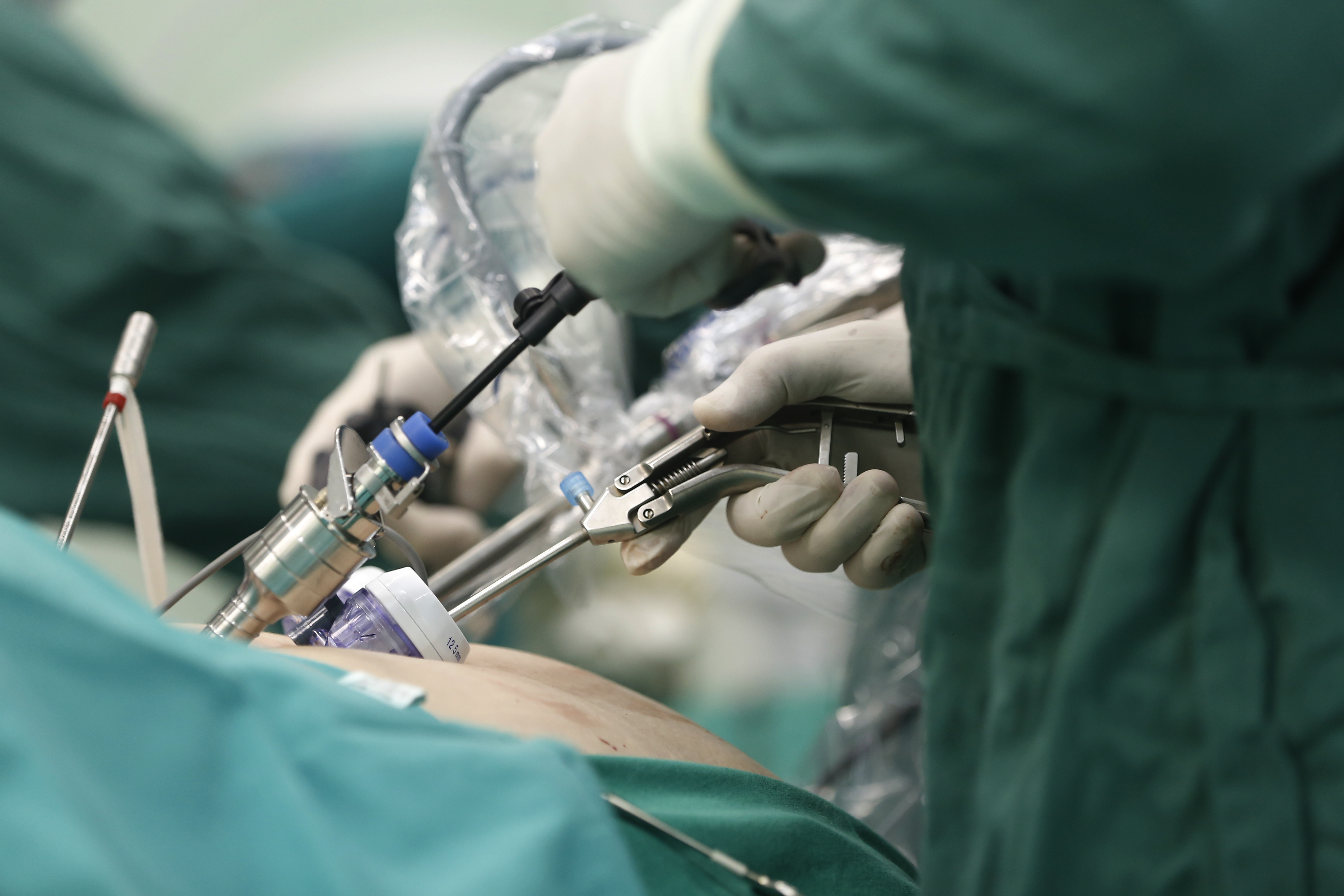 Laparoscopic Hysterectomy Surgery