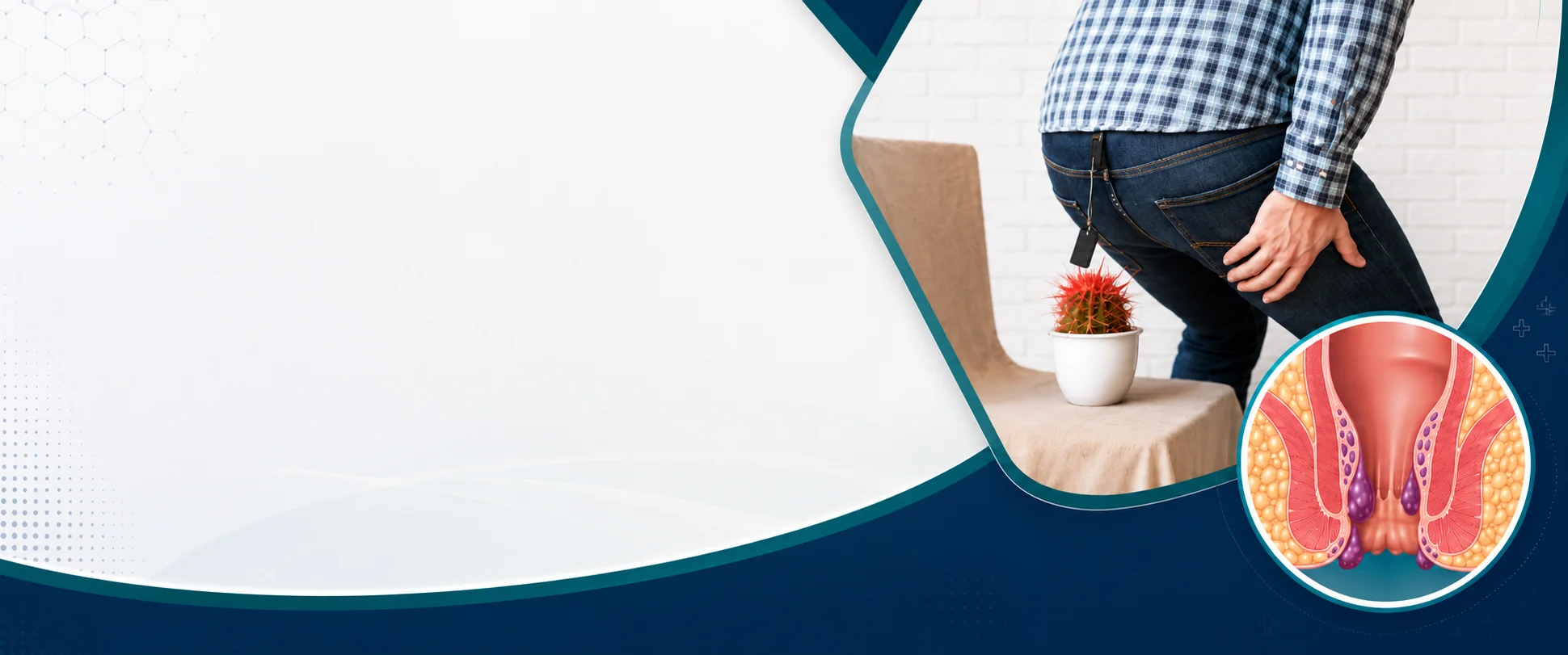 Piles (Haemorrhoids) Surgery in Bangalore - Vasavi Hospitals