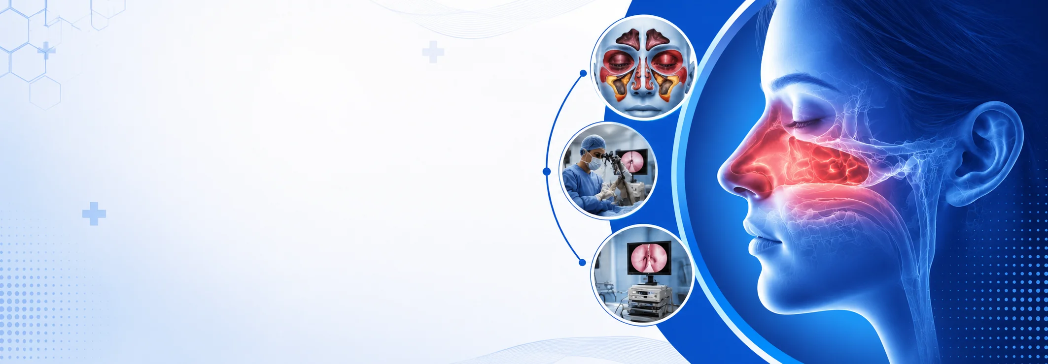 Advanced Sinus Surgery in Bangalore - Vasavi Hospitals