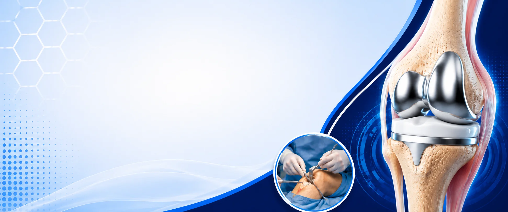 Total Knee Replacement Surgery in Bangalore - Vasavi Hospitals