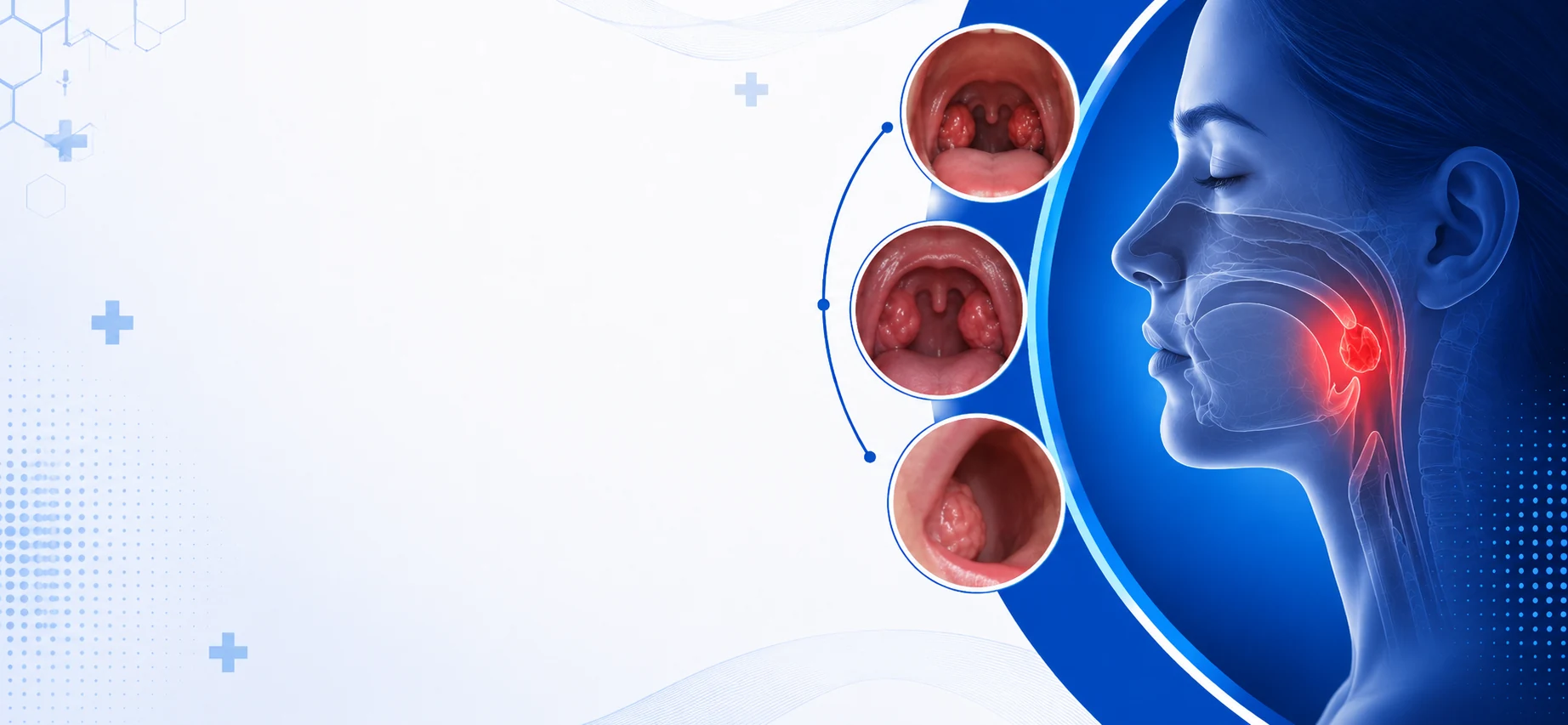 Advanced Tonsillectomy Surgery in Bangalore - Vasavi Hospitals