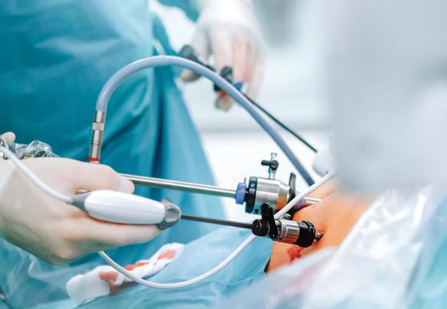 Bariatric Surgery hospital in Bangalore