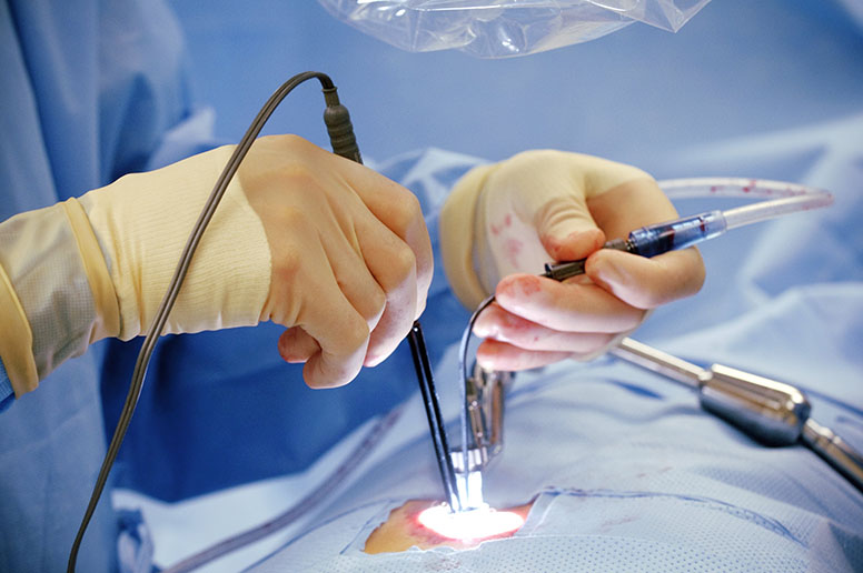Minimally Invasive Surgery Treatment