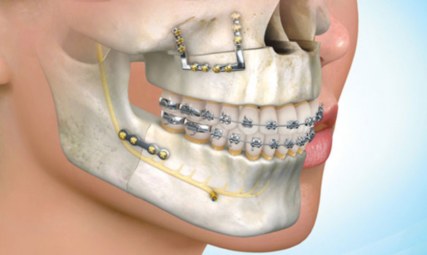Oral & Maxillofacial Surgery Treatment